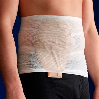 Stomasafe Classic - til både mænd og kvinder